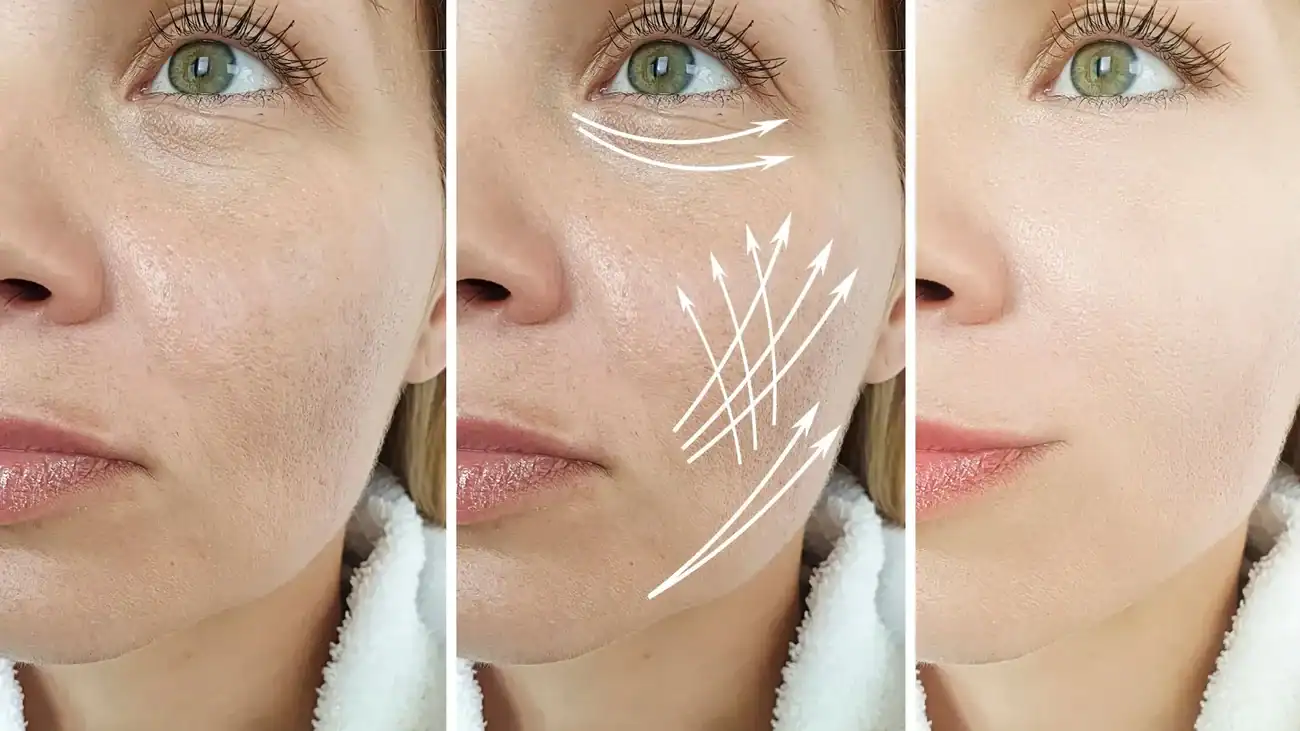 Can One Treatment Really Tackle More Than One Skin Concern Gerrards Cross?
