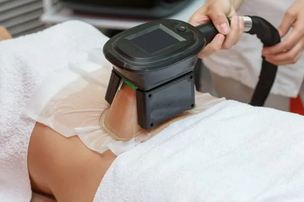 Image of person having fat freezing treatment to help weight gain Gerrards Cross