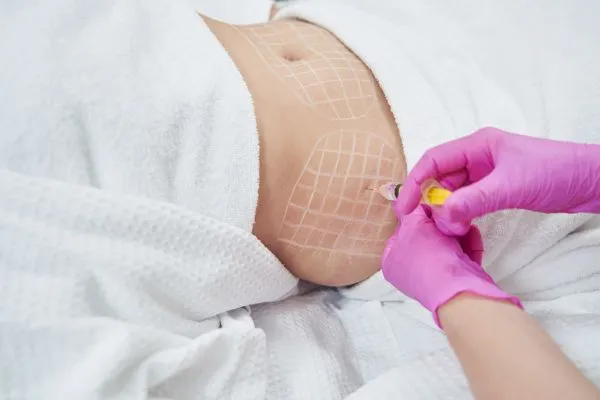 image of fat dissolving injections on love handles to help combat weight gain Gerrards Cross
