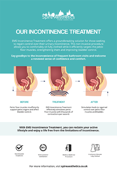 image to show how EMS treatment works for female urinary incontinence Gerrards Cross