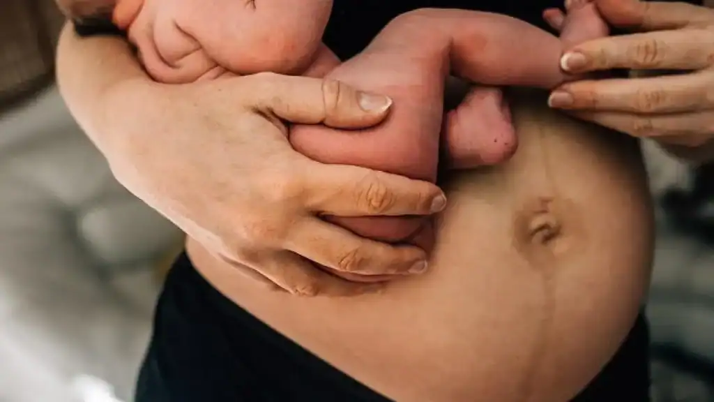 Why Is My Stomach Still Big After Pregnancy Gerrards Cross?