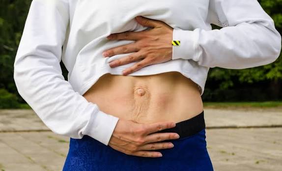 When Could Diastasis Recti Be the Missing Piece of the Puzzle Gerrards Cross?